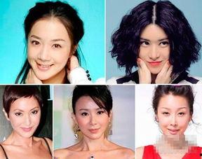 整容变年轻的明星,揭秘整容术下的明星年轻化之路