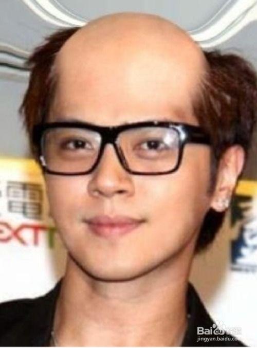 秃头的男明星图