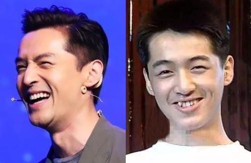 整牙前后明星对比照,颜值飙升，逆袭人生！